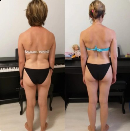 Результат клиентки — до и после